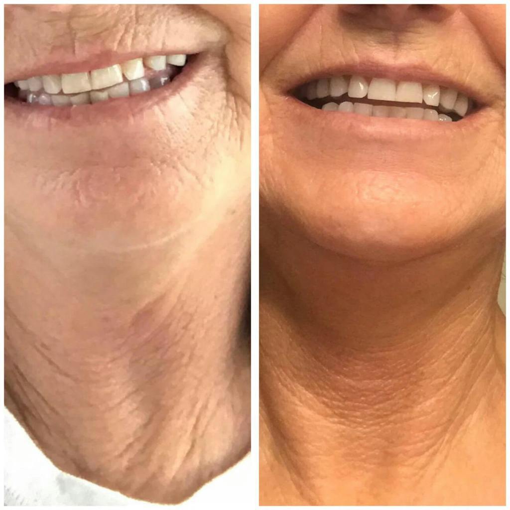 Recensione cliente 1