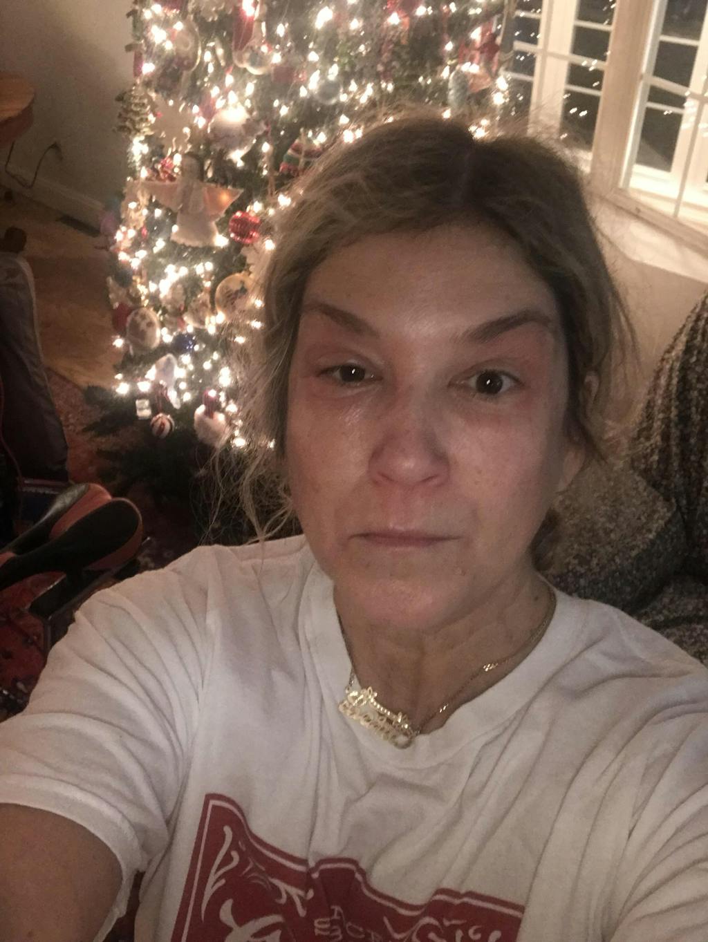 TrueLipids Relieve & Protect Ointment for Dry, Itchy & Eczema-Prone Skin