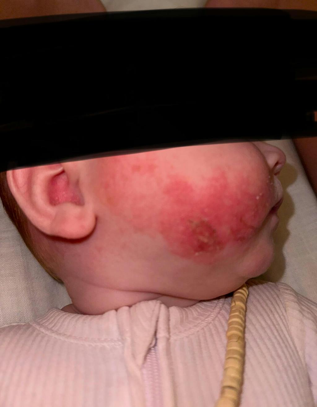 TrueLipids Ultimate Eczema Kit: Eczema Creams and Lotions for Skin Barrier Support