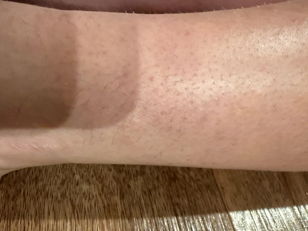 TrueLipids Hydrocortisone Cream for Skin Barrier Support