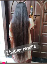 Natural Hair Growth Treatment Oil 🔥 Free Delivery  