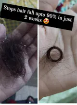 Natural Hair Growth Treatment Oil 🔥 Free Delivery  