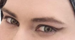 Lentille Planète Forêt Verte