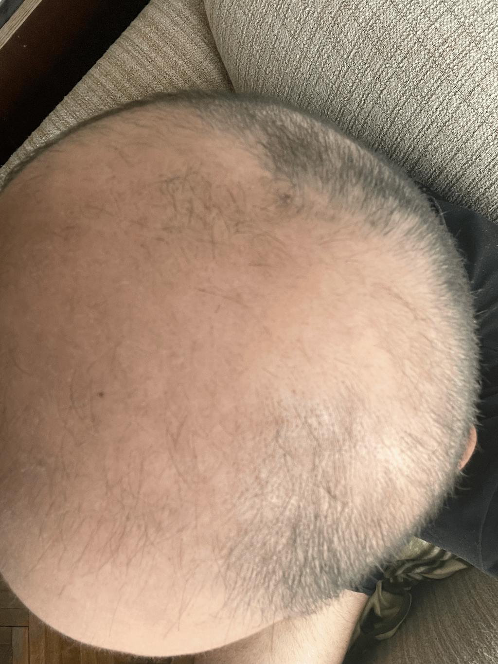 Digital Hair & Scalp Analysis — Personalized Consultation