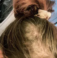 HairBoost