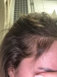 HairBoost