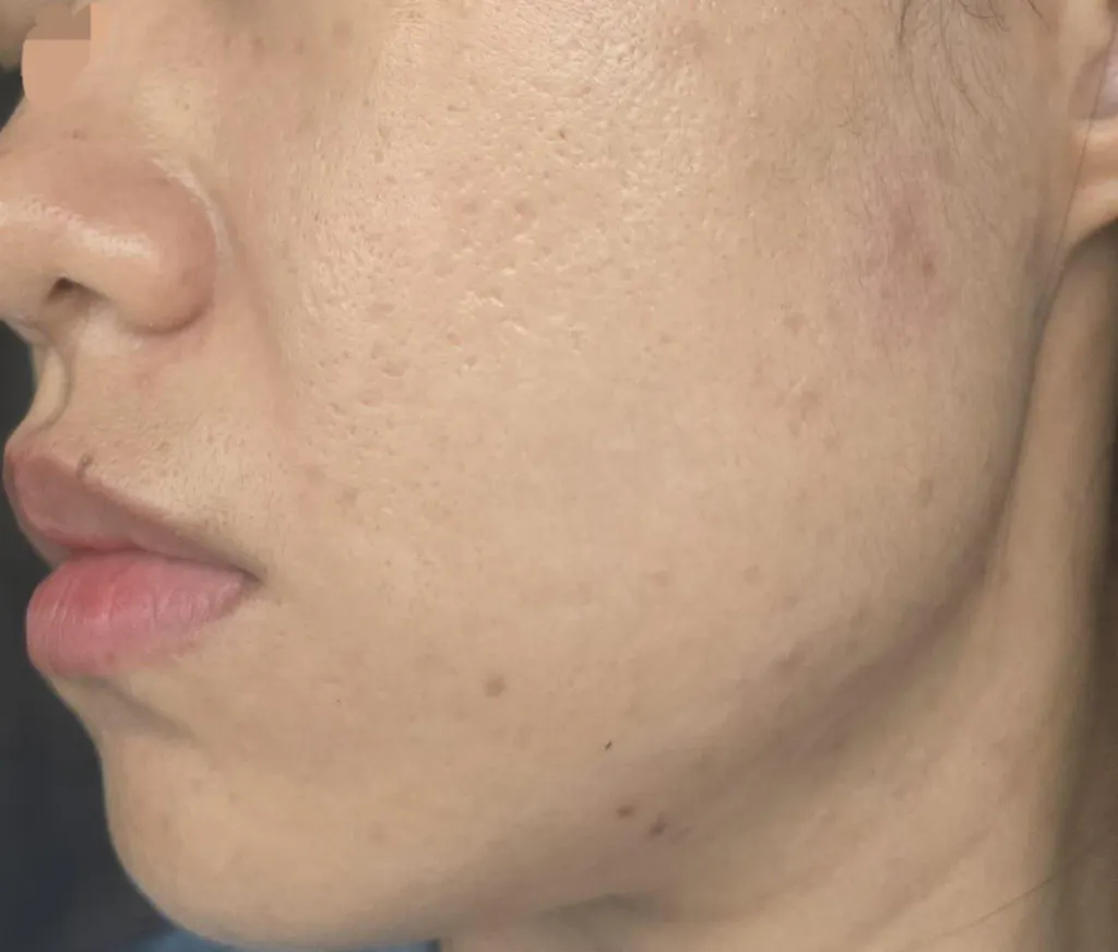 Golden Tomato Oral Sunblock Singapore - Best Skin Whitening Supplement | UV Protection, Brighten Skin & Fade Dark Spots