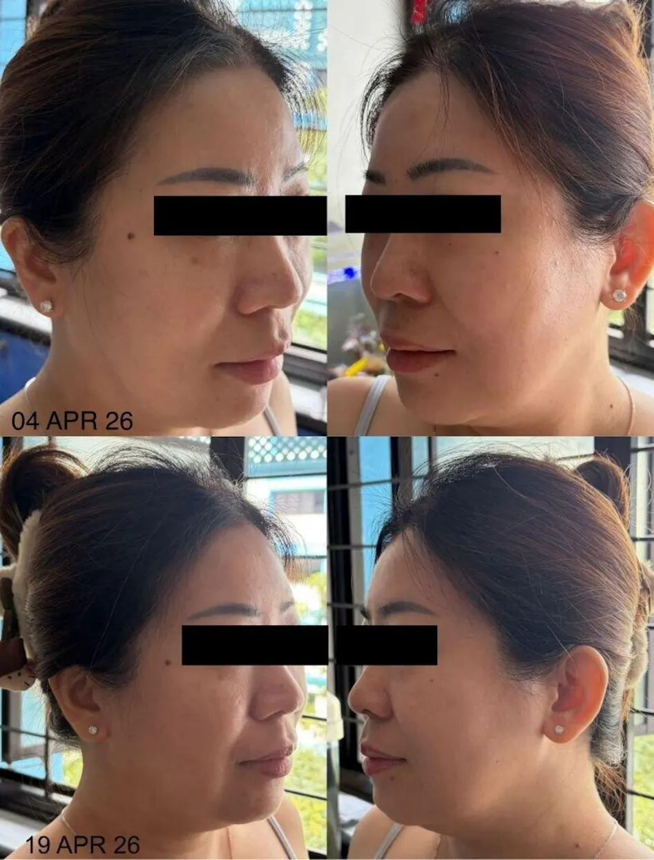 aura white l glutathione review Happy Customers