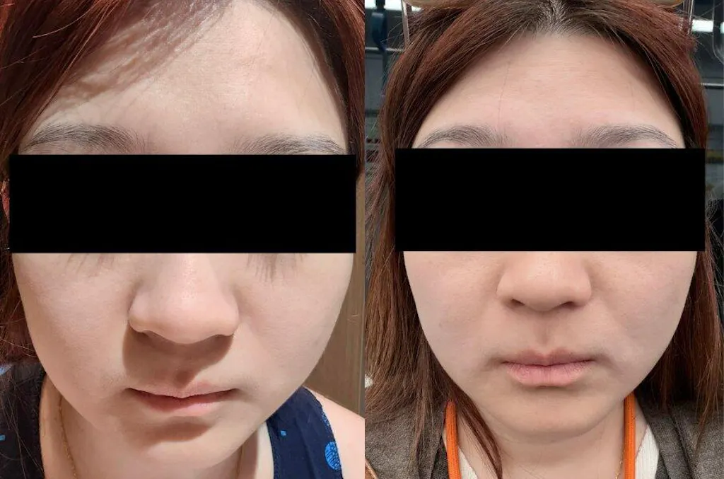 Golden Tomato Oral Sunblock Singapore - Best Skin Whitening Supplement | UV Protection, Brighten Skin & Fade Dark Spots