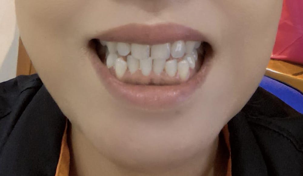 PAP+ Whitening Strips (7 Strips)