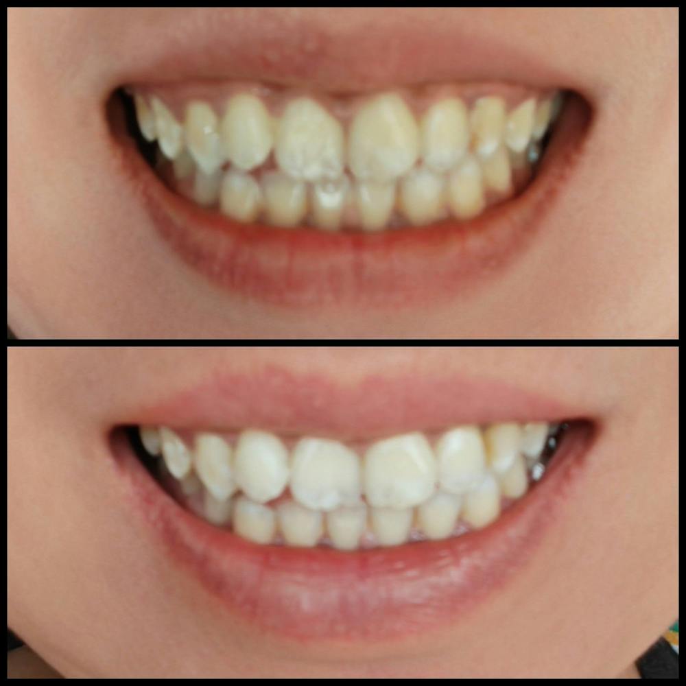 Probiotic Whitening Toothpowder