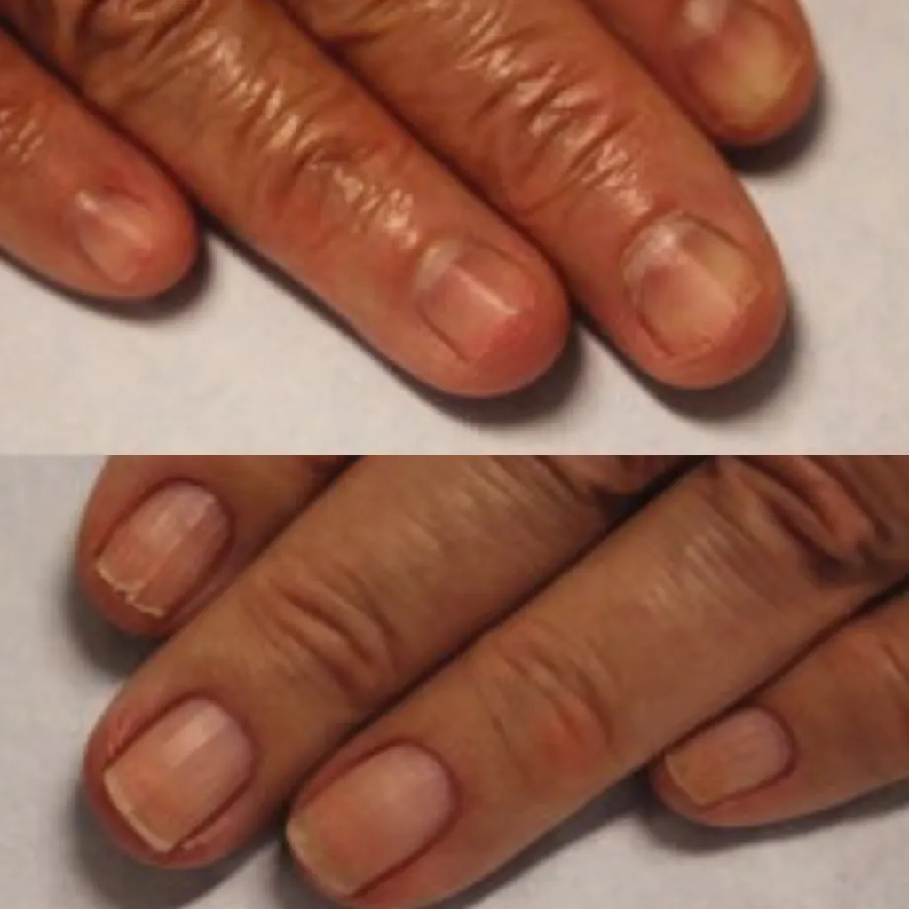 NailRevive Prime Nail Serum with DualPeptide Formula™