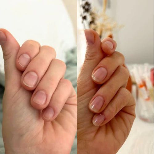 NailRevive Prime Nail Serum with DualPeptide Formula™