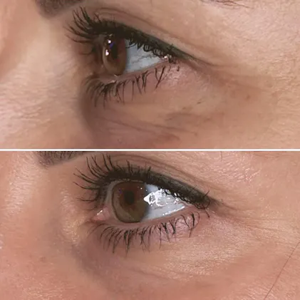 AXXZIA BEAUTY EYES Essence Sheet Premium Plus - Кругові патчі