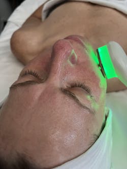 Leaf Fusion Plasma