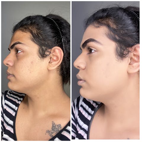 Ultime Pro HD Runway Ready Foundation