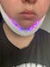 Facial Lifting Device Double Chin Remove