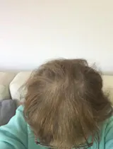 FEG PLUS Hair Growth Spray