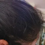 FEG PLUS Hair Growth Spray