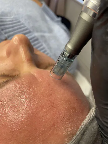 Dr.pen Ultima M8 Cartucce di ricambio a 11 pin, ricambio originale Dr Pen per penna Microneedling modello M8, cartucce di ricambio usa e getta autentiche (11 pin, 10 pezzi
