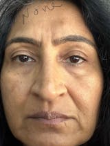 Langzame maar gestage vooruitgang