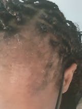 Anoint - Hair Growth Oil For Thinning Hair & Edges