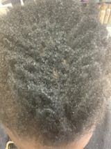 Anoint - Hair Growth Oil For Thinning Hair & Edges