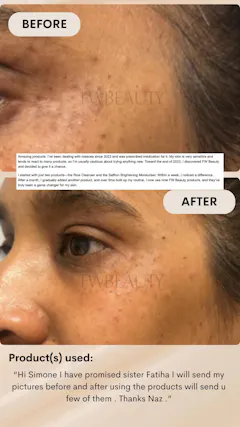 Review picture