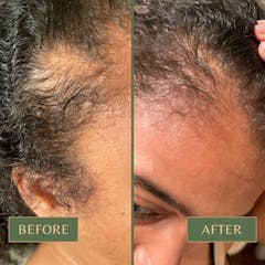 Review picture Review picture