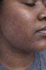 Detox Clay Face Mask – Purify and Revive for Clear Skin