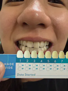 Review picture