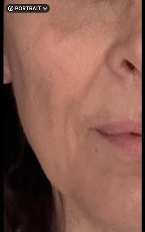 The Fountain of Youth Elixir by GlindaWand