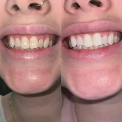 Review picture