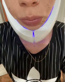 SnatchBand - By Glowistry