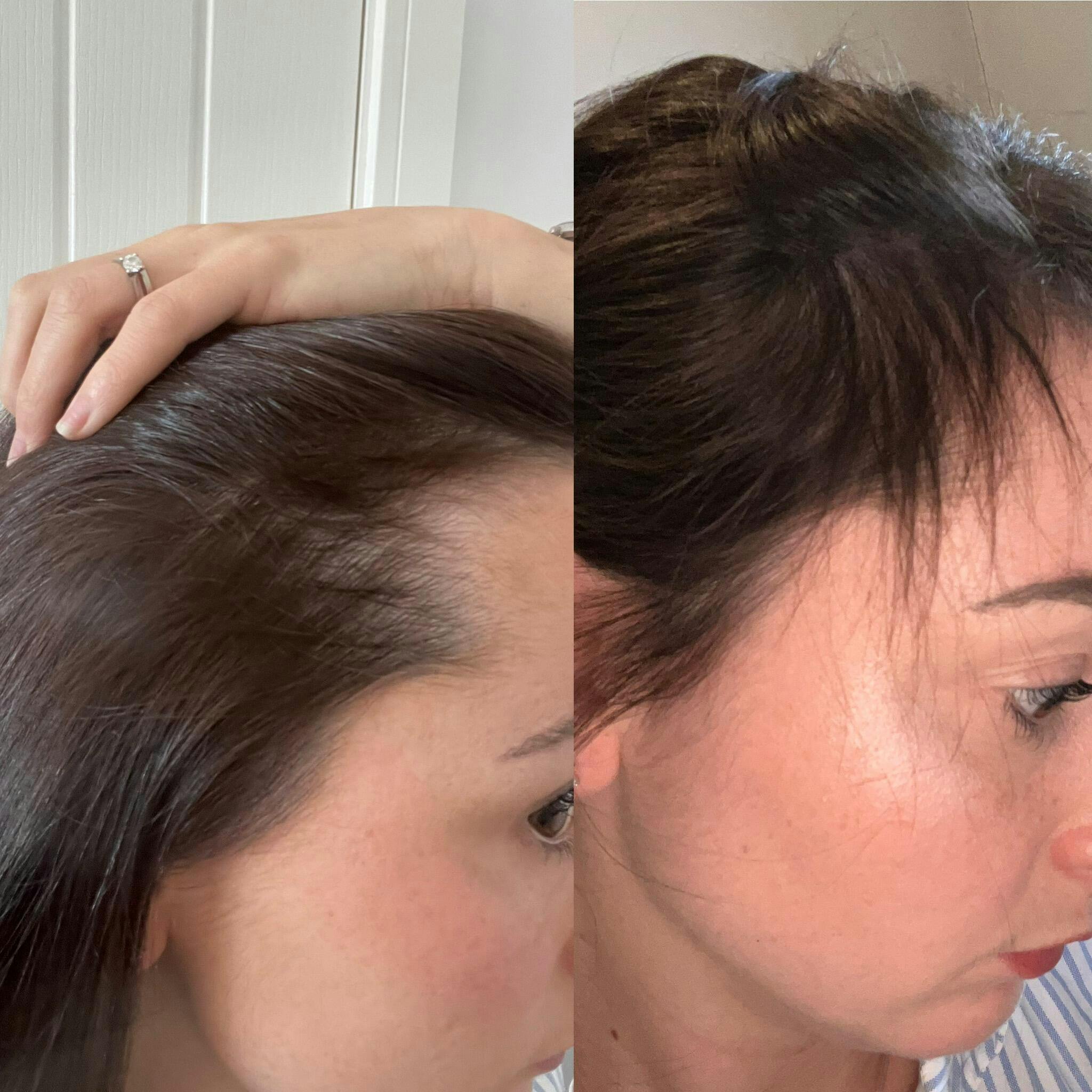 HAIR FOOD Hair Vitamins, 60 Capsules GLOWWA