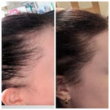 HAIR FOOD | MENO - 1 Month Supply