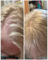 HAIR FOOD | MENO - 3 Month Supply