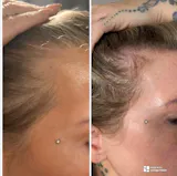 HAIR FOOD | MENO - 1 Month Supply