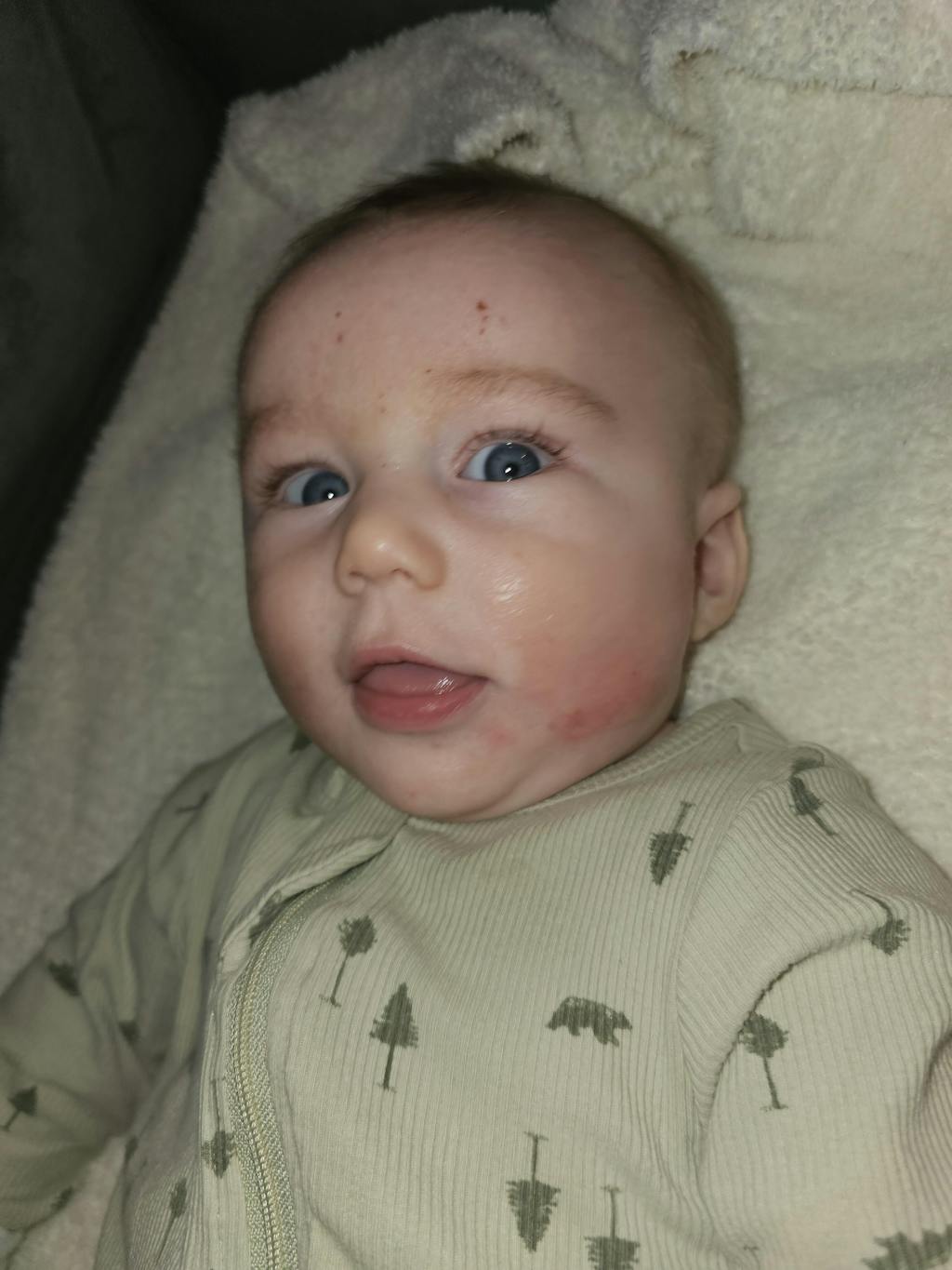 Baby Eczema Pack *Limited Edition* Grahams Natural USA