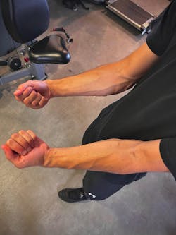 HANDGRYP