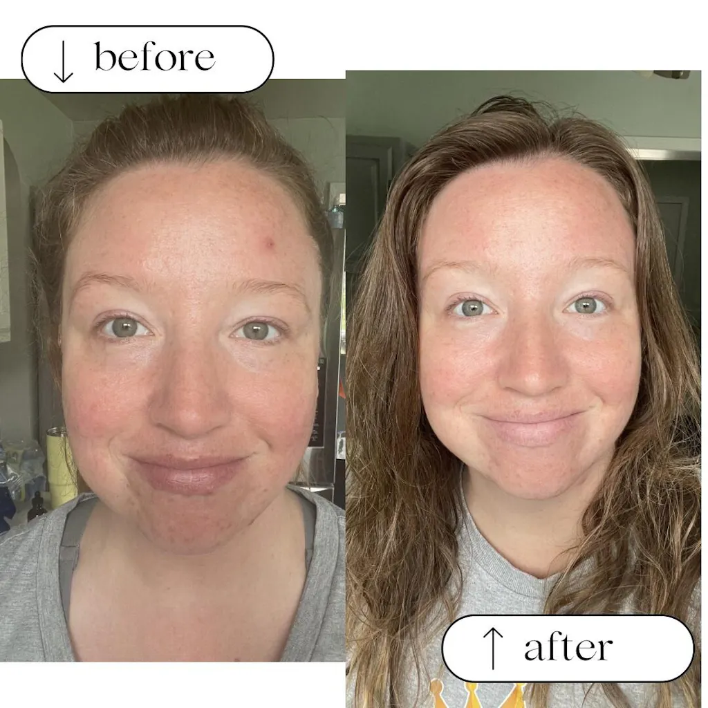 Cleansing Oil (Oily or Acne Prone Skin)