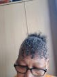 H.H Hair Growth Bundle - Medium