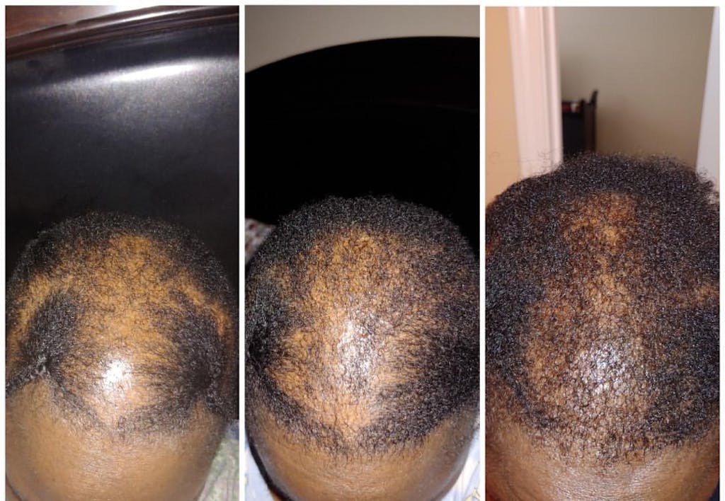 Reviews Hair Growth Co