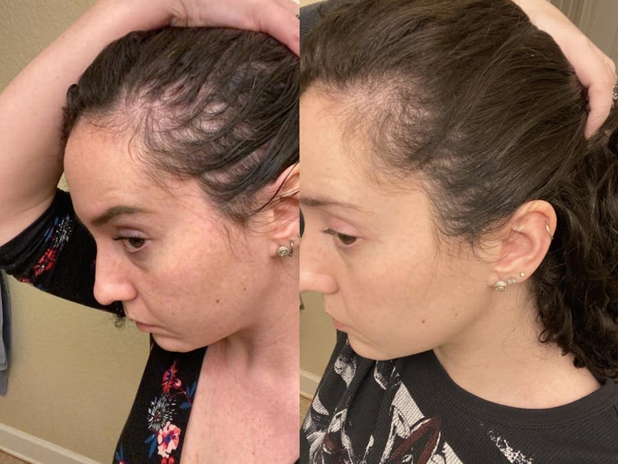 Hairgrowthco Hair Growth Co