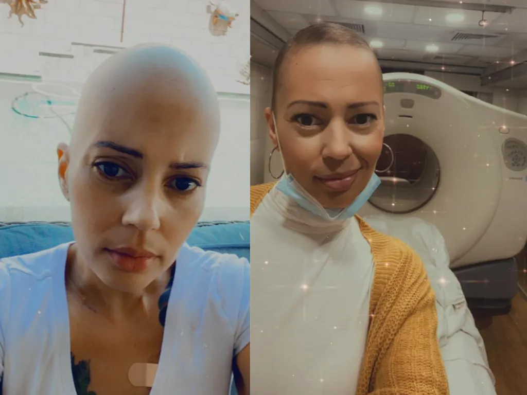 10 in 1 Hair Growth Oil Hair Loss Treatments Hair Growth Co