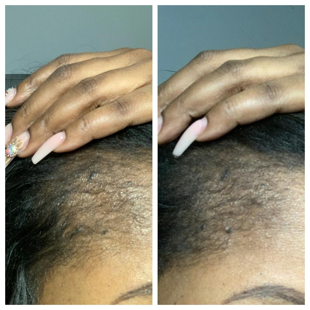 Reviews Hair Growth Co