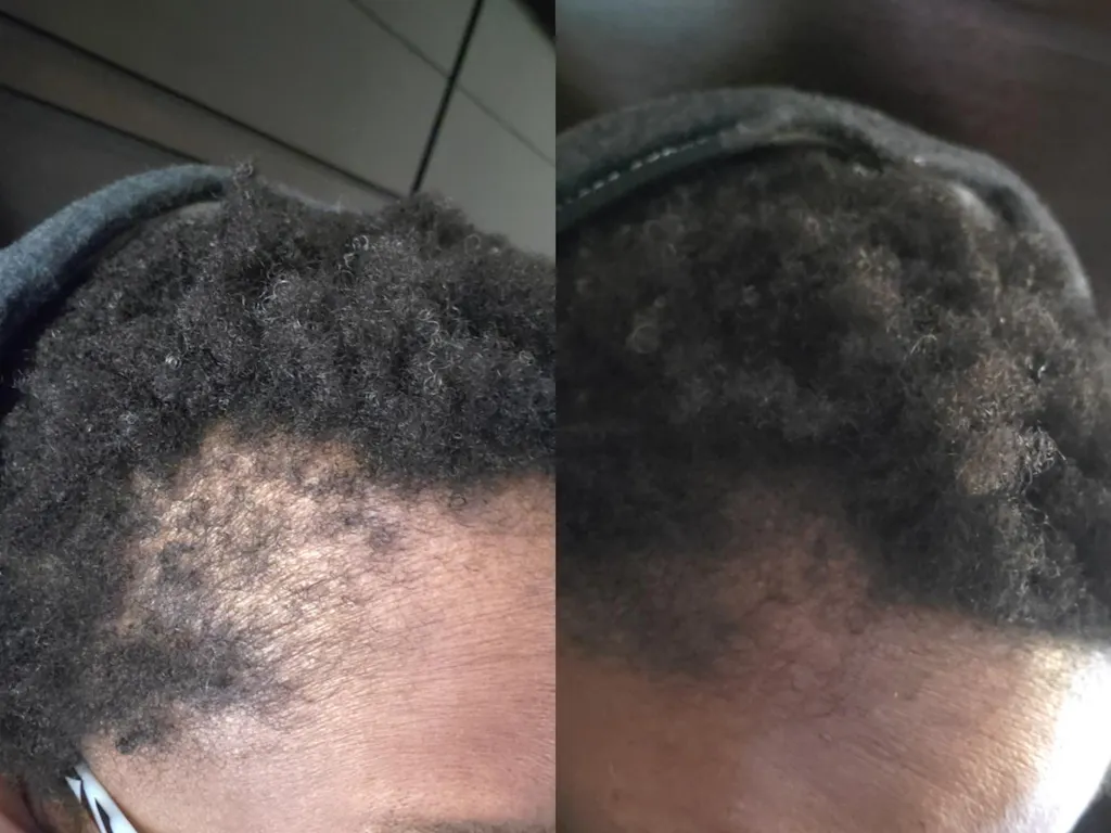 10 in 1 Hair Growth Oil (2oz.) Hair Growth Co