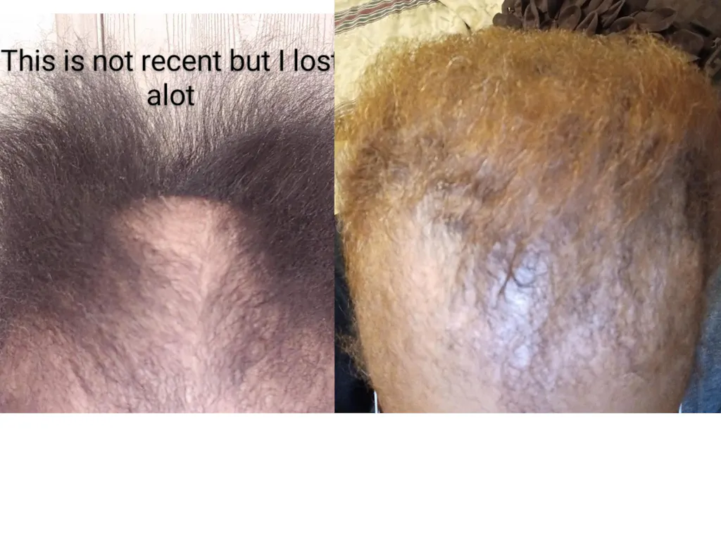 10 in 1 Hair Growth Oil (2oz.) Hair Growth Co