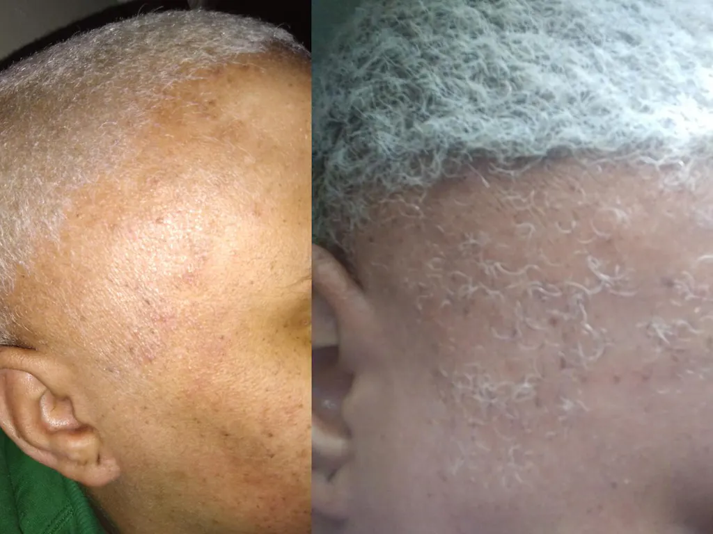 10 in 1 Hair Growth Oil (2oz.) Hair Growth Co