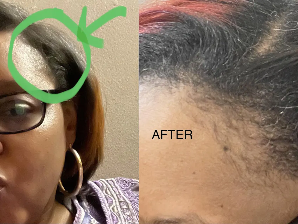 10 in 1 Hair Growth Oil (2oz.) Hair Growth Co